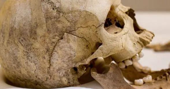 Additional article image