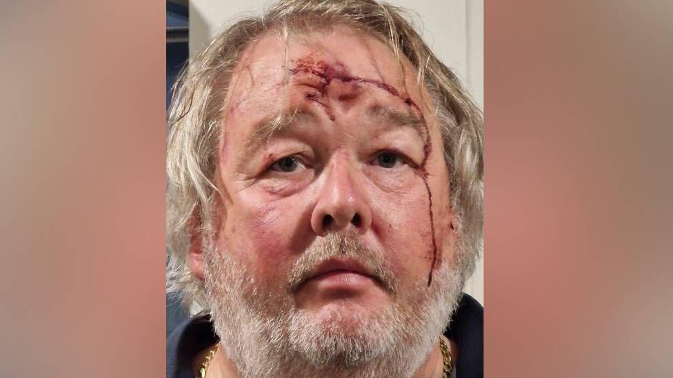 Additional article image